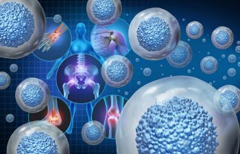 Stem cell Therapy for Orthopedic and Chronic Pain Conditions